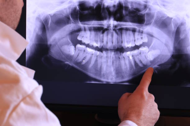 Best Urgent Tooth Repair  in Taft, CA
